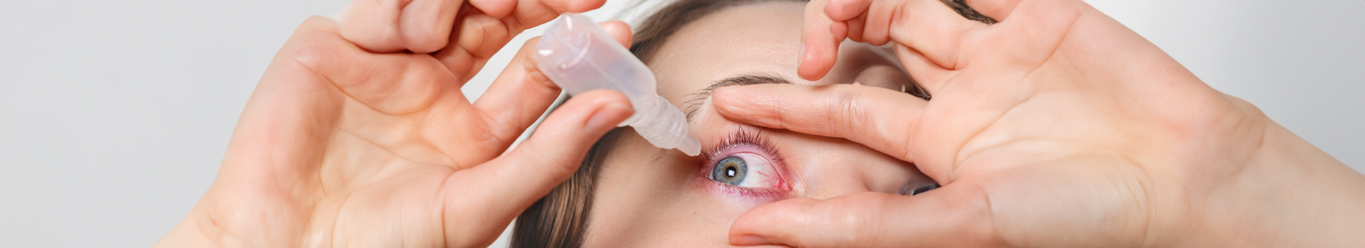 Pink Eye Treatment New York